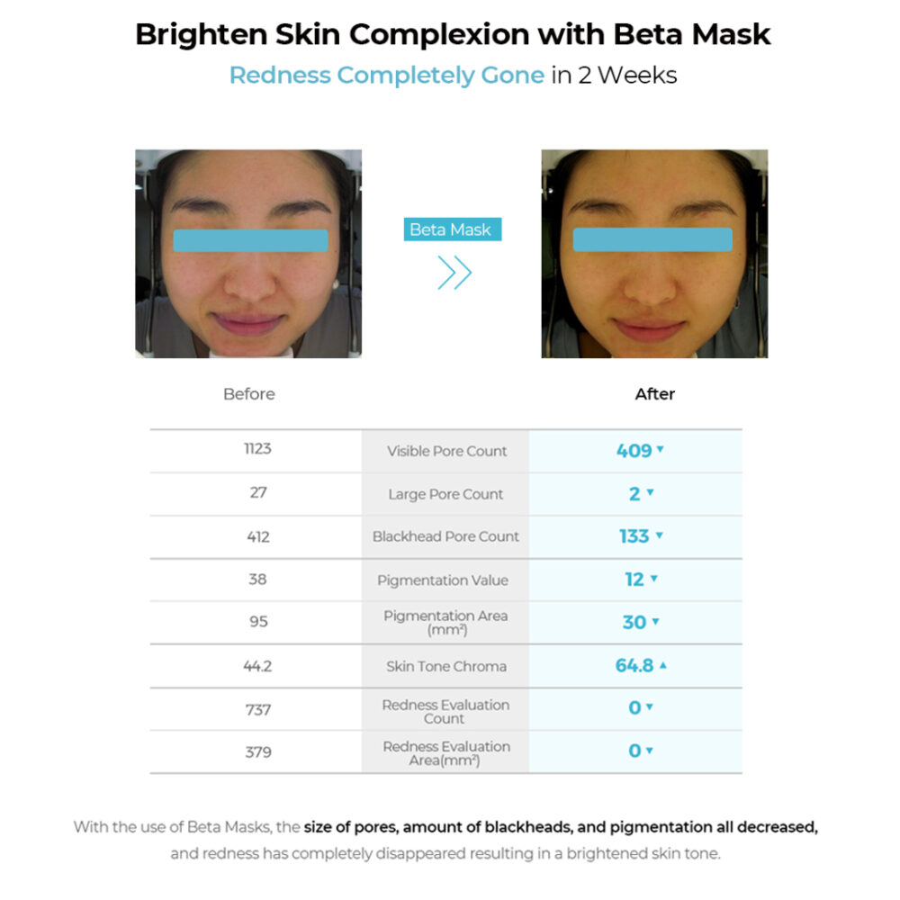 BETA MASK - Image 4