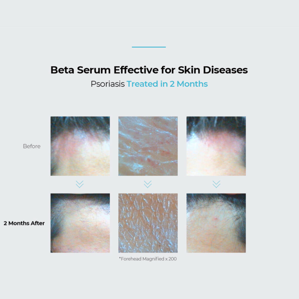 BETA SERUM - Image 5