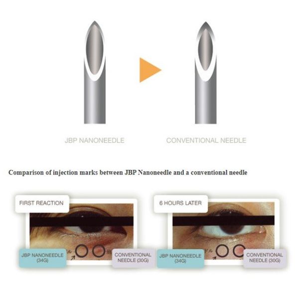 JBP Nanoneedle 30G x 13mm - Image 2